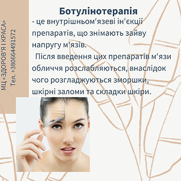 Ботулінотерапія