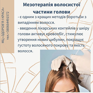 Мезотерапія волосистої частини голови